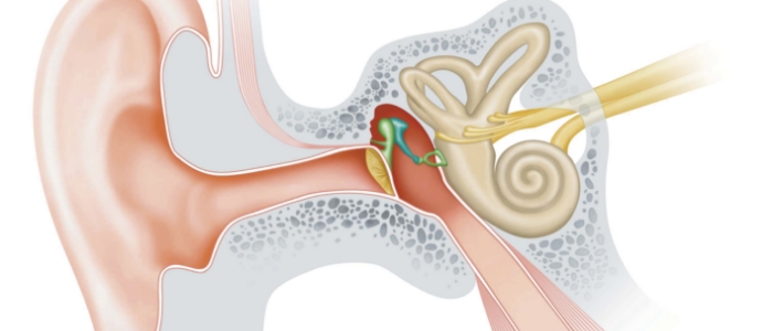 難聴の原因と「きこえ」の仕組み
